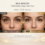LED Eye Mask – 7-Color Photon Light Therapy for Eye Area Skincare