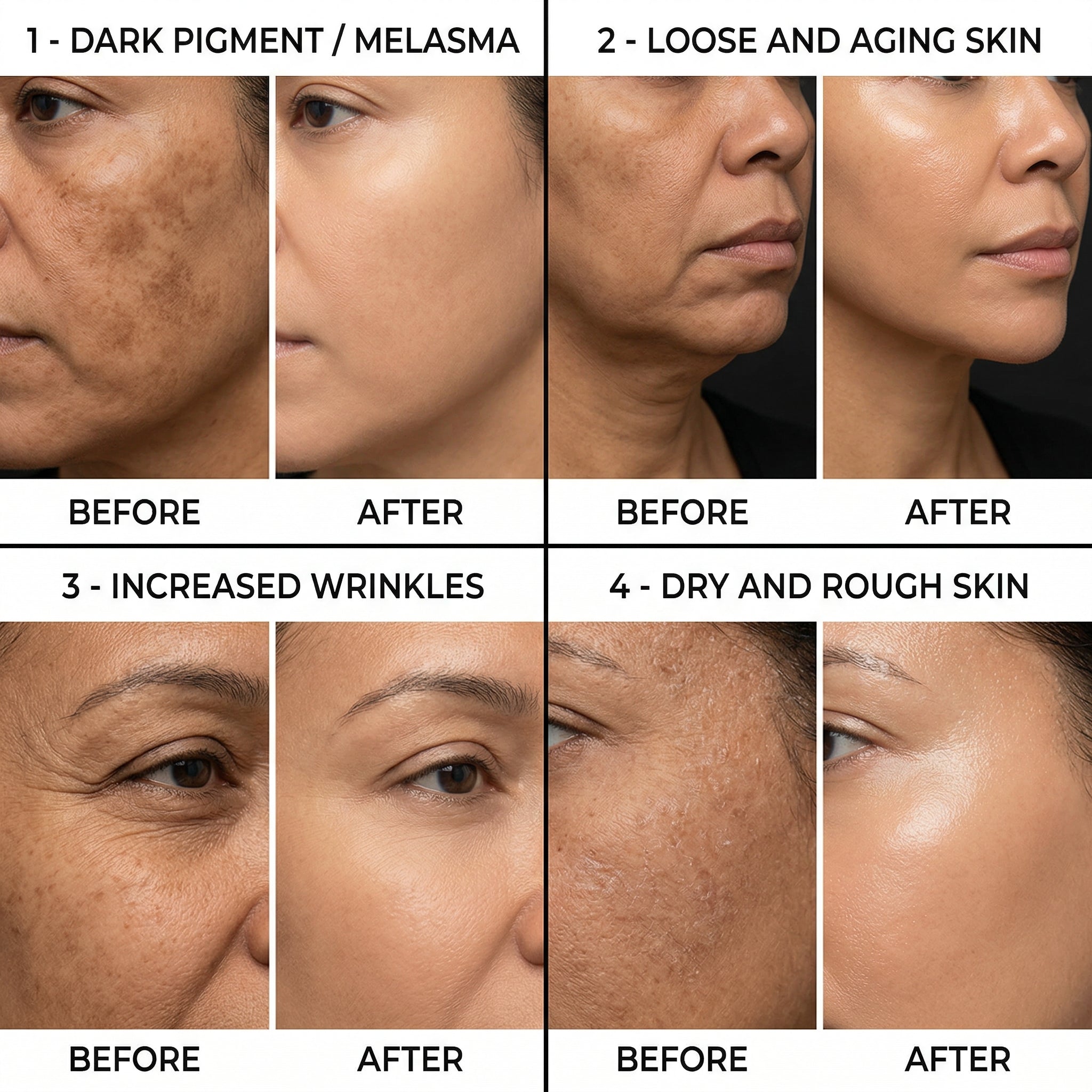 Before and after comparison of skin treatments for dark pigment, loose aging skin, wrinkles, and dry rough skin.