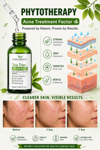 Green Tea Anti-Acne Essence Liquid