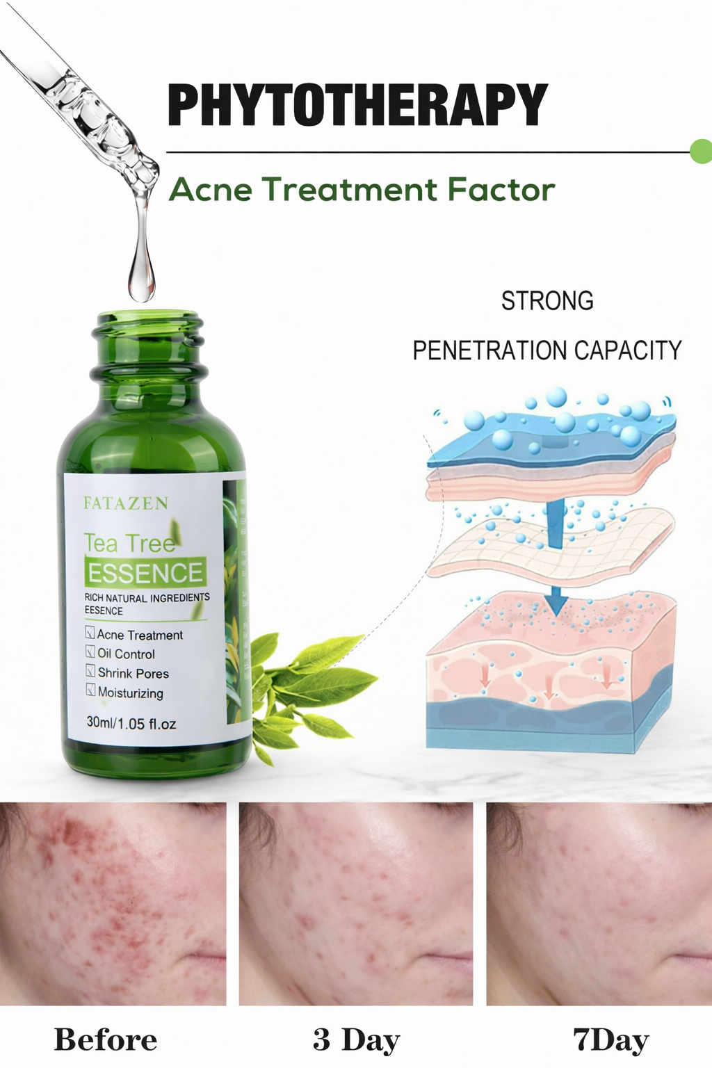 Tea tree essence bottle with before, during, and after effects on skin, labeled 'Phytotherapy Acne Treatment Factor'.